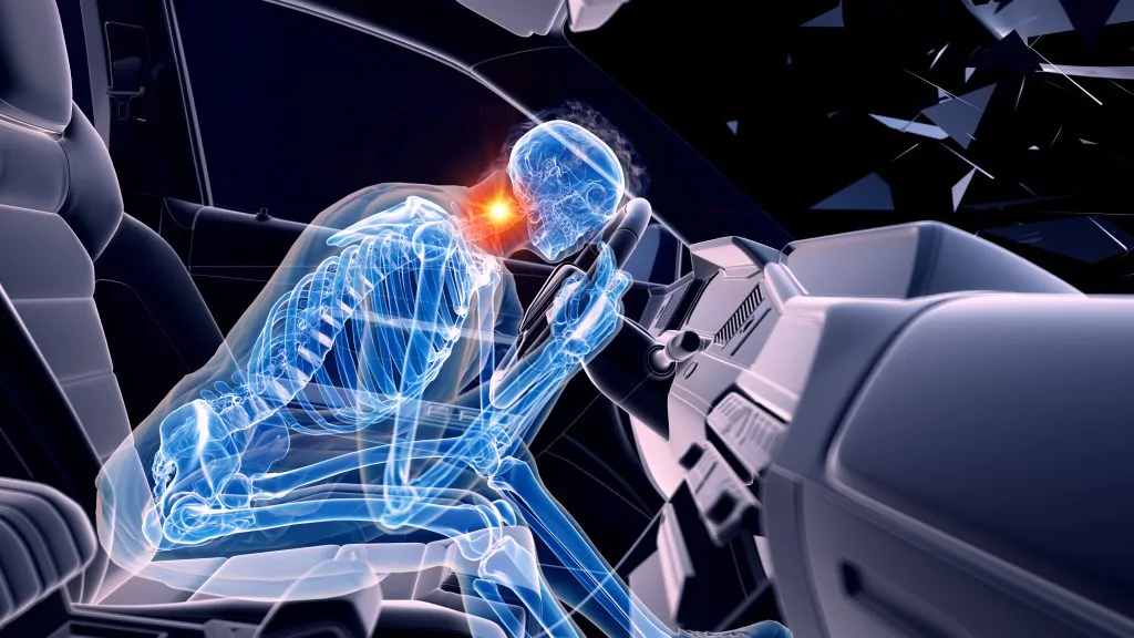 Whiplash Injury Statistics & Settlements